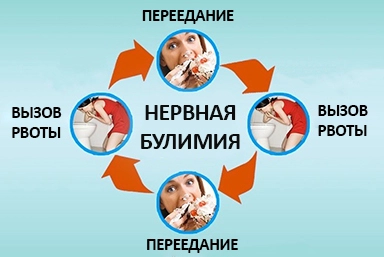 Лечение булимии в Малгобеке